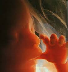 Zupnick botched  abortions 