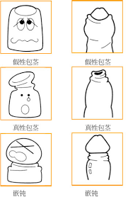 包茎是怎么回事