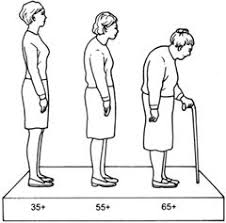 Osteoporosis: Not just for - via Daymix