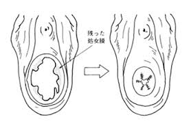 尚、処女ならば皆処女膜を残して