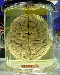 Formaldehyde (H2CO) is a basic - via Daymix