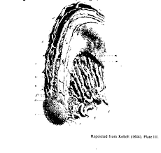 of the clitoris seen from