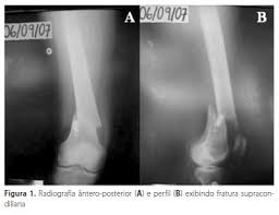 http://www.scielo.br/img/revistas/rbme/v15n2/a11fig01.jpg