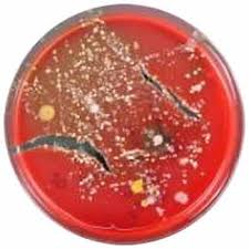 http://www.vawatchdog.org/07/pix07/acinetobacter-wht.jpg