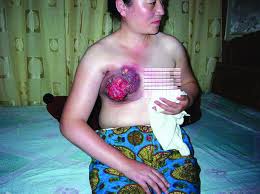 The vulnerability of women to    