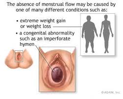 Absence of Menstruation