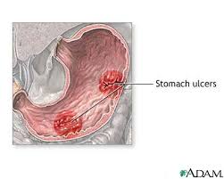 or mucous membrane caused - via Daymix
