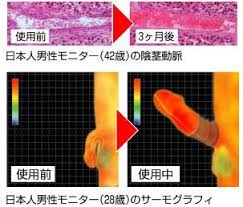 なリングでペニスの勃起力を