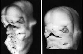 http://embryology.med.unsw.edu.au/notes/images/head/CleftPrimaryPalate1619.jpg