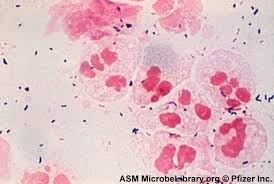 Chlamydia - GGCWiki - via Daymix