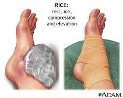 Minor  injuries  like sprains
