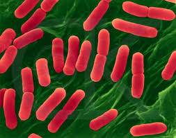   Eubacteria   The x26quot true bacteria x26quot 