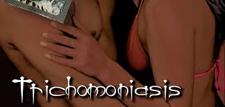  Trichomoniasis  (Trich)