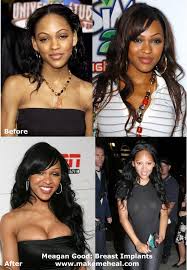 Image Is <b>Meagan Good</b>’s Plastic Surgery Bad <b>...</b> Picture