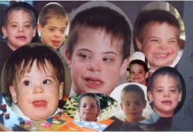 with Down's Syndrome: - via Daymix