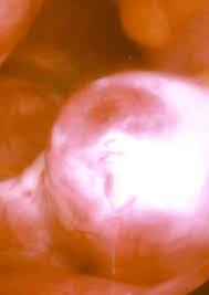 Impending  Ovulation   This is an ovary    