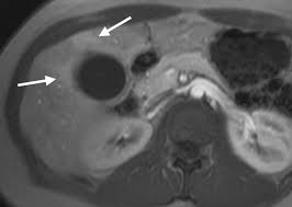 http://radiology.rsna.org/content/244/1/174/F7.large.jpg