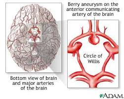 http://www.nlm.nih.gov/medlineplus/ency/images/ency/fullsize/17031.jpg