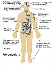 What Causes Fibromyalgia?