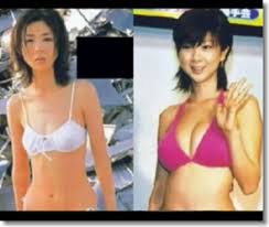 「芸能人整形 美容整形で