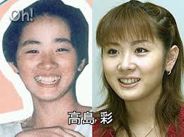 赤外線盗撮！！！ 整形発覚！