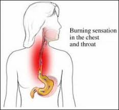 How to Heal  Acid Reflux Symptoms  