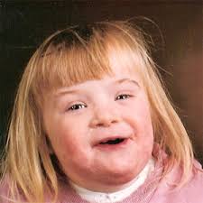 for down syndrome - via Daymix