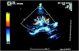 An  ultrasound  screen shows a