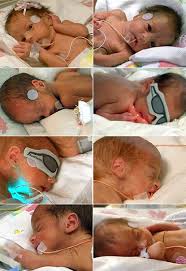 babies to the world | News - via Daymix