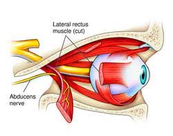 http://img.tfd.com/MosbyMD/thumb/abducens_nerve.jpg