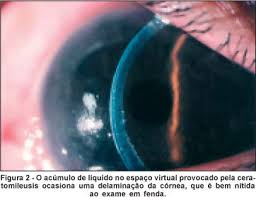 http://www.scielo.br/img/revistas/abo/v70n1/32f2.jpg