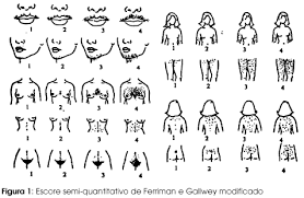 http://www.scielo.br/img/fbpe/abem/v46n2/10601f1.gif