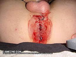   double anal   piercing