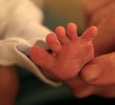  Babinski Reflex 