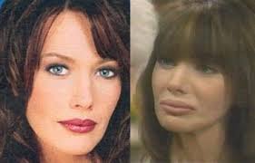 Image <b>Hunter Tylo</b> Plastic Surgery Picture