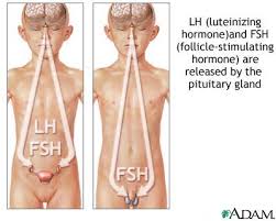  Hypopituitarism  is a condition