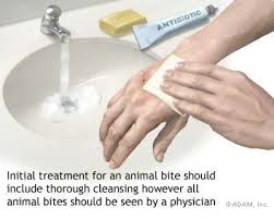  Animal bites 