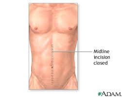  Abdominal exploration  - series