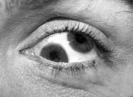   double   eye