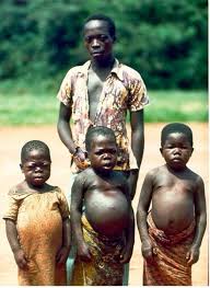 Republic of Congo.
