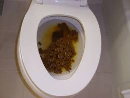 All kinds of  poo   coming out of ya 