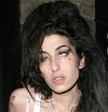 Amy Winehouse hospitalized - via Daymix