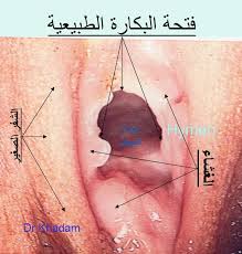 Images found for اكبر بظر:
