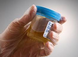 Urine therapy - via Daymix