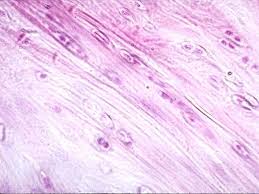   Fibrocartilage  