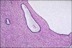 http://library.med.utah.edu/kw/human_reprod/mml/hrovt_fem124.jpg