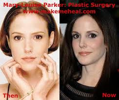 Image The show’s star, <b>Mary Louise Parker</b> <b>...</b> Picture
