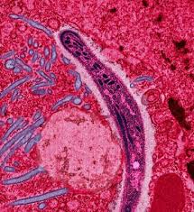 Description: Malaria is - via Daymix