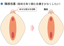 HOME >> 診療メニュー >> 女性器