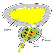 and preventive against BPH